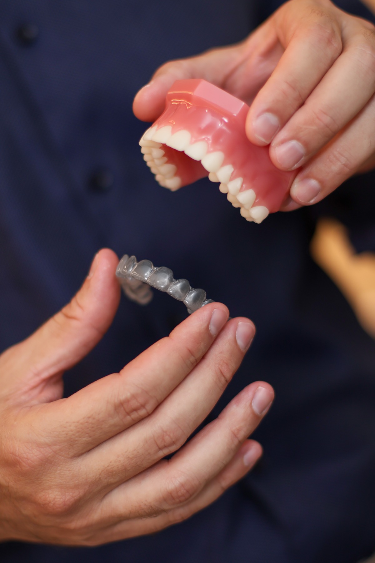 Demonstração de um alinhador transparente junto a um modelo dos dentes